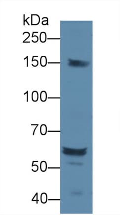 DOK1 Antibody (aa18-237, APC)