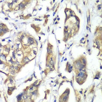 Polyclonal Rabbit anti-Human NFS1 Antibody (IHC, IF, WB)