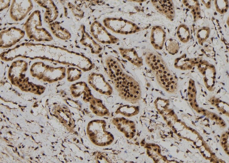 Polyclonal Rabbit anti-Human FOXR1 Antibody (IHC, IF, WB)