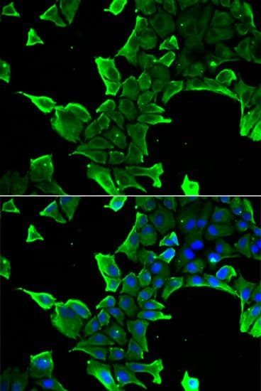 NCS1 / Neuronal Calcium Sensor Antibody