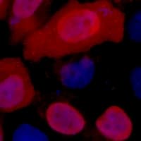 Monoclonal Mouse Myc Tag Antibody (IF, WB)