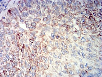 BCL2L10 / Diva Antibody (clone 8A2F9)