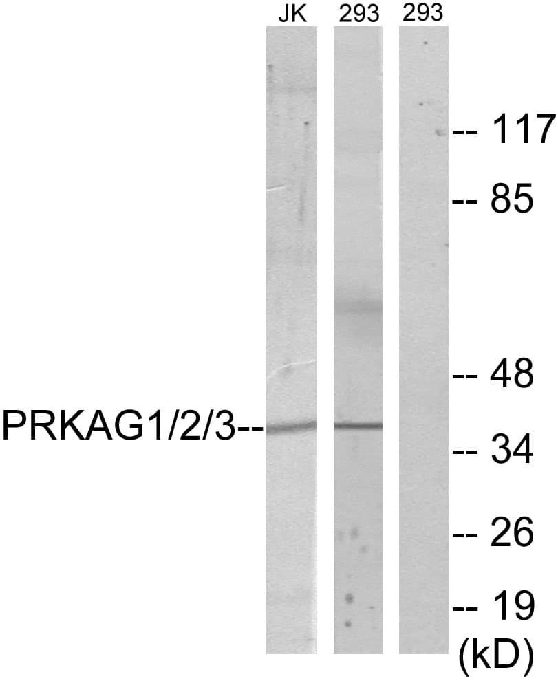 Polyclonal Rabbit anti-Human PRKAG1+2+3 Antibody (Internal, WB)