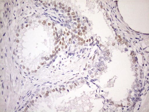 Monoclonal Mouse anti-Human AR / Androgen Receptor Antibody (clone OTI1D3, aa420-659, IHC, WB)