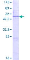 Human BDNF Protein (Recombinant GST)