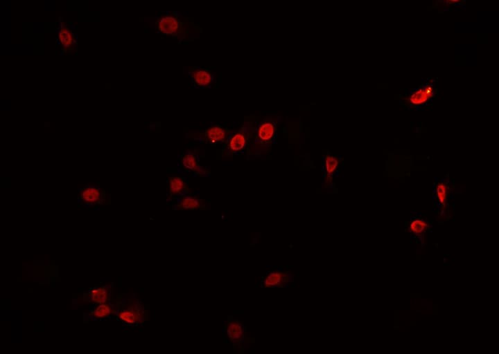 Polyclonal Rabbit anti-Human CO-029 / TSPAN8 Antibody (IF, WB)