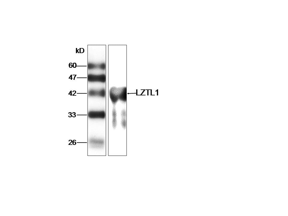 Monoclonal Mouse anti-Human LZTFL1 Antibody (WB)