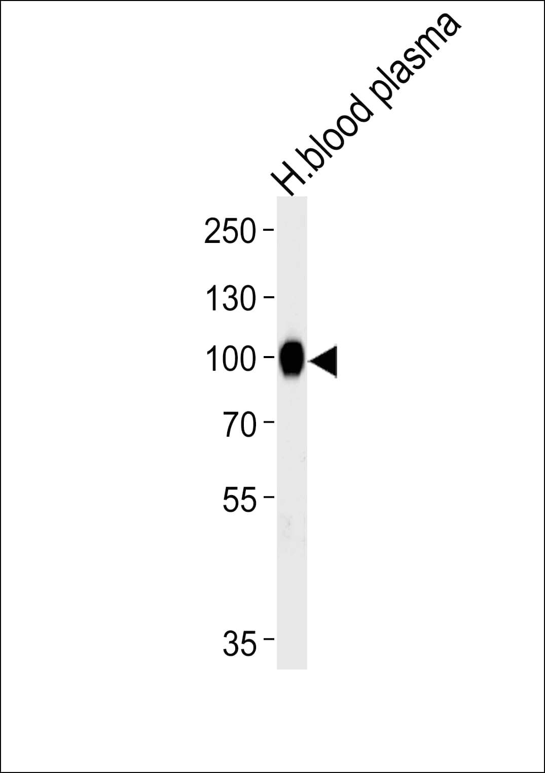 Polyclonal Rabbit anti-Human PLG / Plasmin / Plasminogen Antibody (aa150-175, WB)