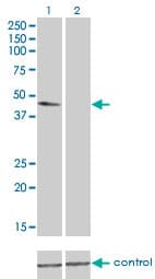IHC-plus™ Monoclonal Mouse anti-Human TUBA4A / TUBA1 Antibody (clone 2E11, IHC, IF, WB)