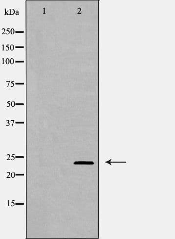 RAB11A Antibody