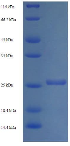 Human ARL4A / ARL4 Protein (Recombinant His)
