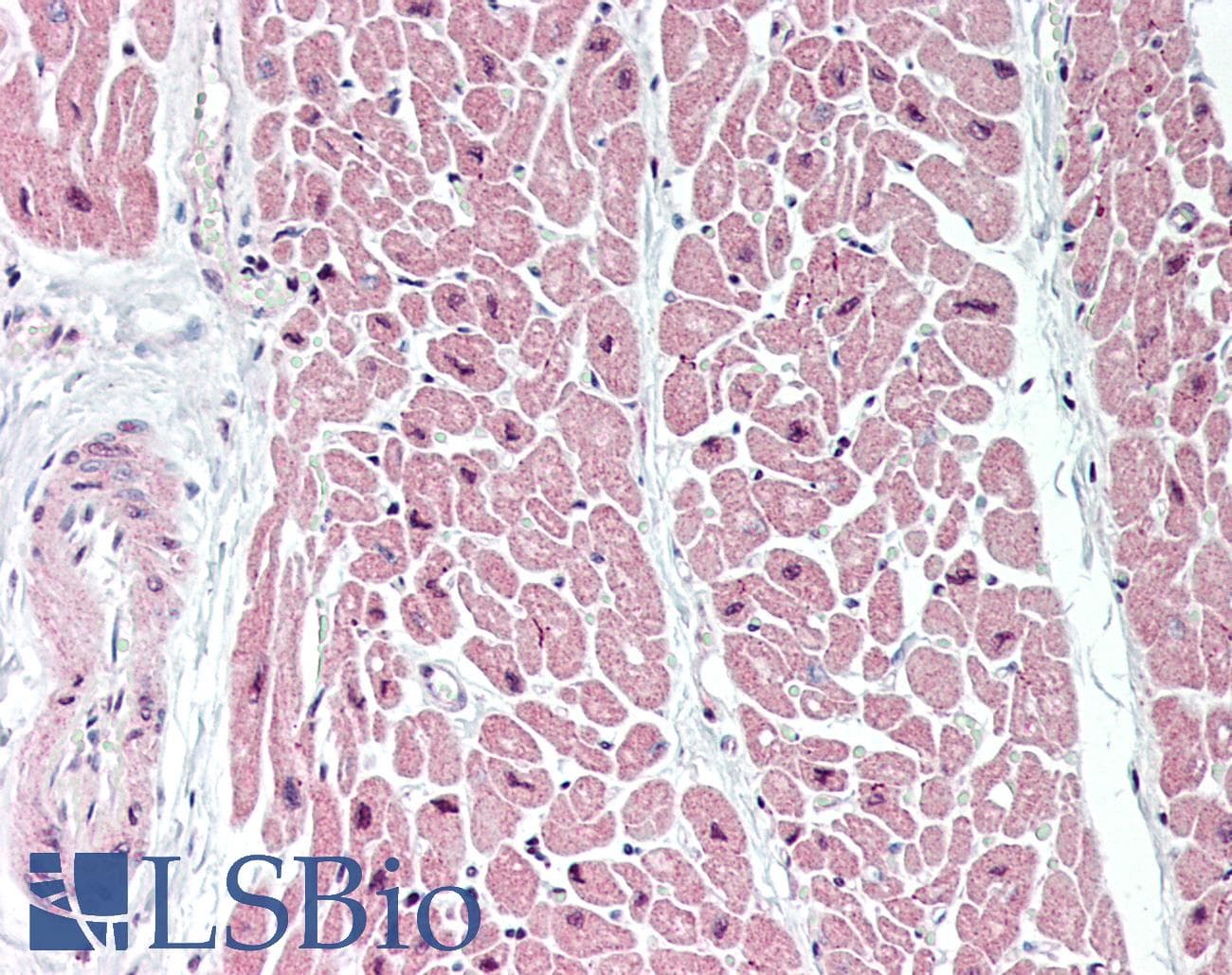 IHC-plus™ MT-ND1 Antibody (Internal)