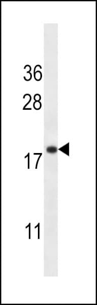 Polyclonal Rabbit anti-Human TMEM70 Antibody (aa231-260, IHC, WB)