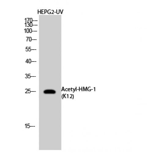 Polyclonal Rabbit anti-Human HMG1 / HMGB1 Antibody (N-Terminal, WB)