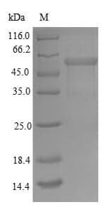 Human TOMM34 Protein (Recombinant GST, N-terminus)