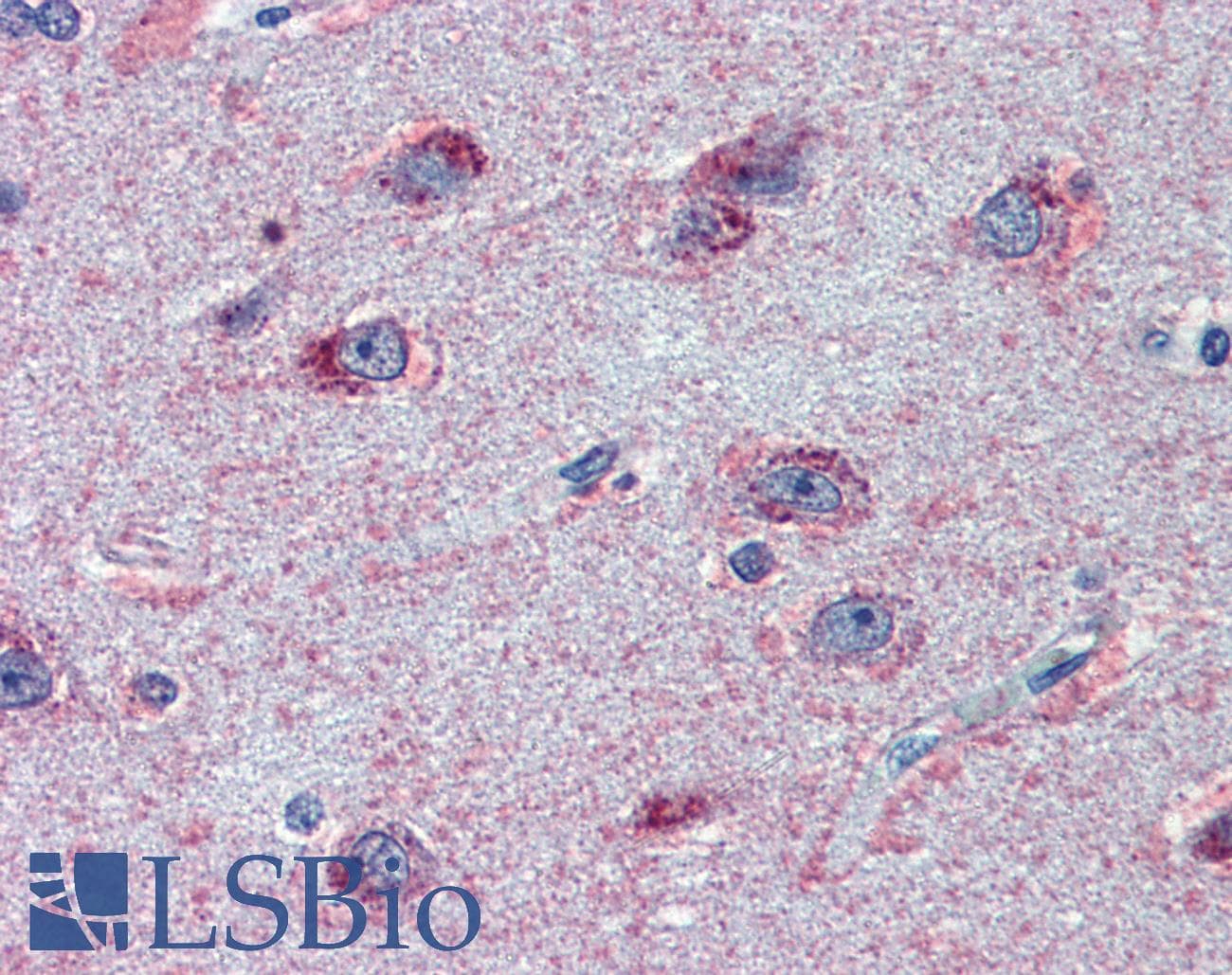 IHC-plus™ Polyclonal Goat anti-Human FMR1 / FMRP Antibody (aa116-130, IHC, WB)