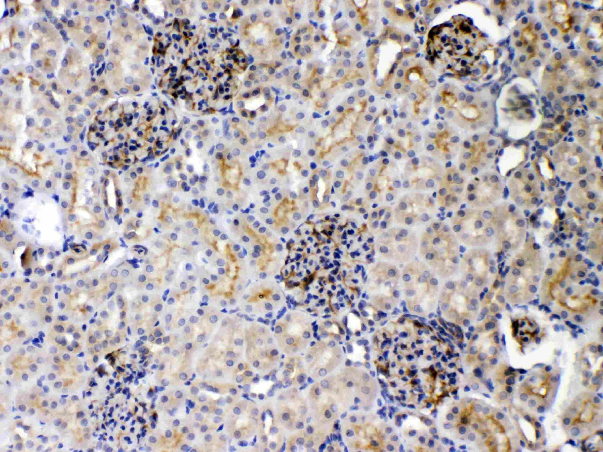 TNFRSF10B / Killer / DR5 Antibody