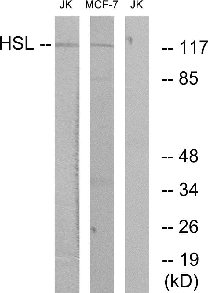 Polyclonal Rabbit anti-Human LIPE / HSL Antibody (p552, IHC, WB)