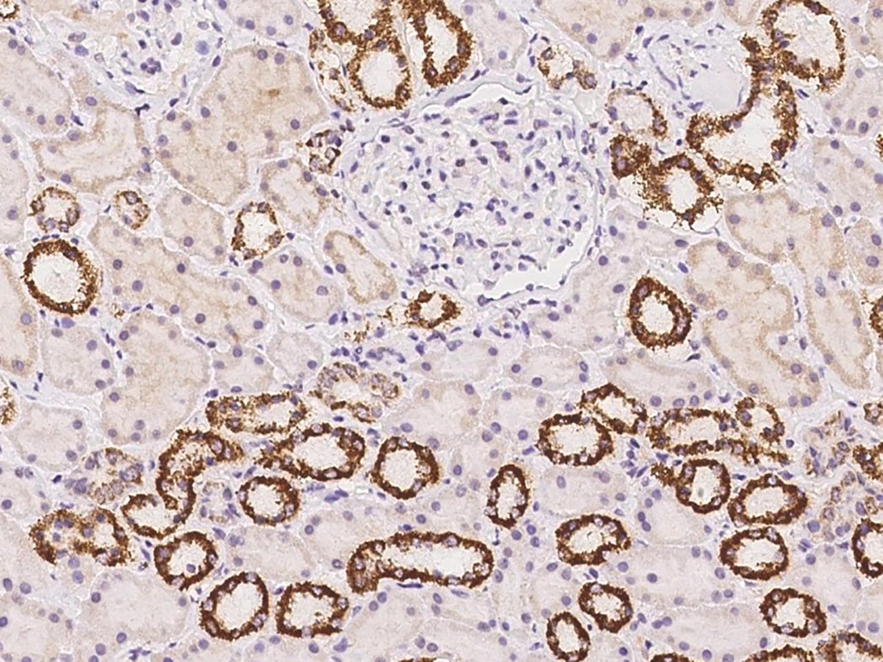 Polyclonal Rabbit anti-Human LOC388813 Antibody (IHC)
