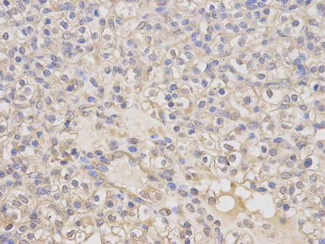 IHC-plus™ Polyclonal Rabbit anti-Human KLK1 / Kallikrein 1 Antibody (IHC, WB)