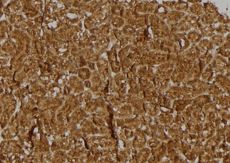 BRWD3 Antibody