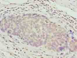 Polyclonal Rabbit anti-Human ZNF177 / PIGX Antibody (IHC)
