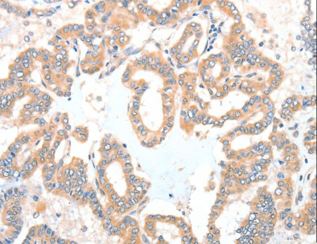 ADCK1 Antibody
