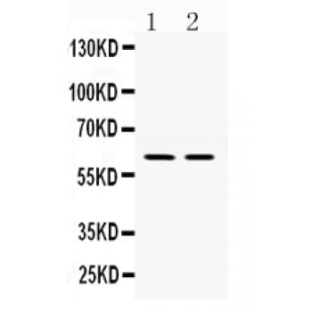 Polyclonal Rabbit anti-Human RELB Antibody (aa219-252, WB)