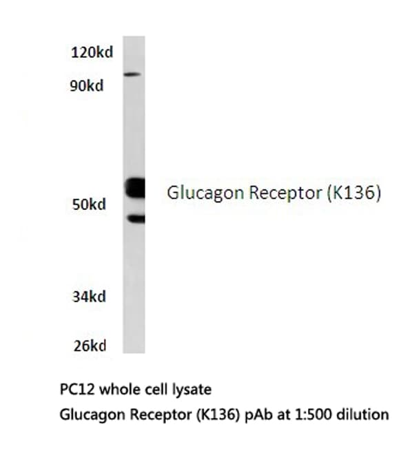 GCGR / Glucagon Receptor Antibody (Lys136)