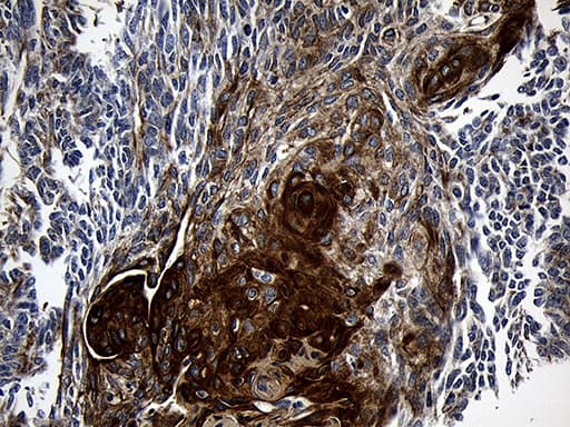 CPT1B Antibody (aa187-440, clone OTI2A6, Carrier-free)