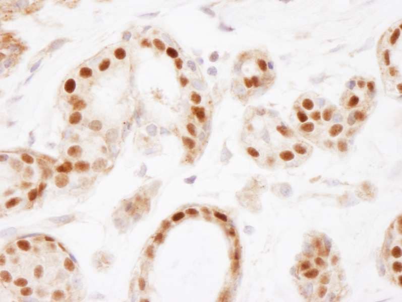 Polyclonal Rabbit anti-Human ER Alpha / Estrogen Receptor Antibody (aa1-50, IHC)