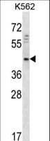 Polyclonal Rabbit anti-Human DOC2A Antibody (aa277-306, IHC, WB)