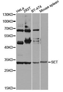 SET / TAF-I Antibody