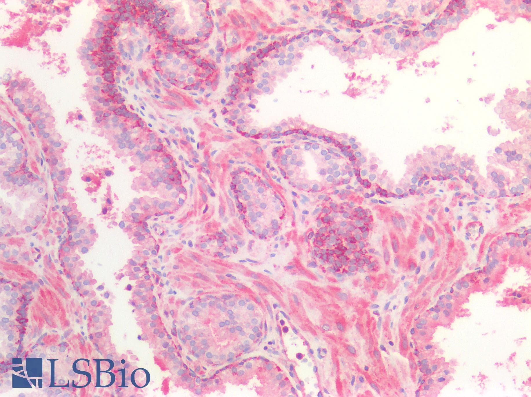 IHC-plus™ ACVR2 / ACVR2A Antibody (aa20-140)
