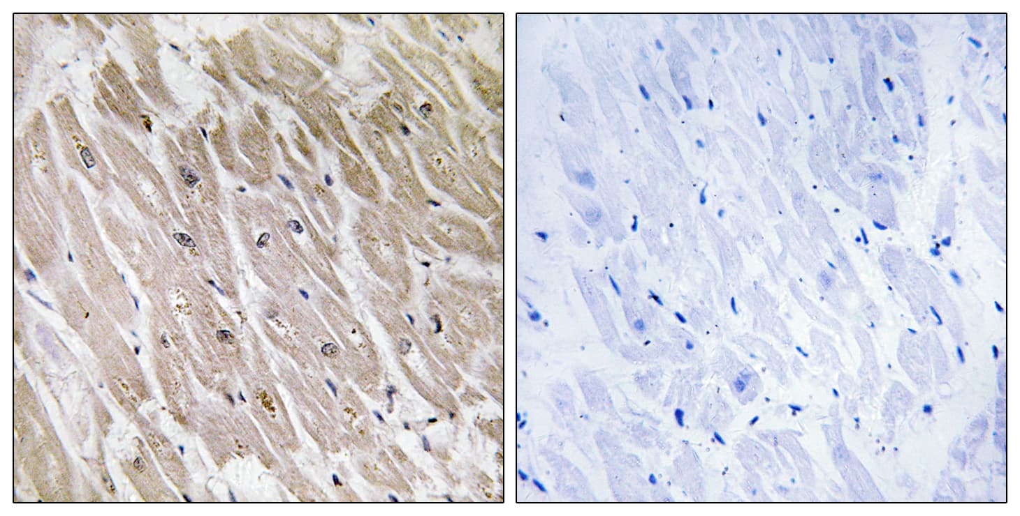 ACAD10 Antibody (aa231-280)