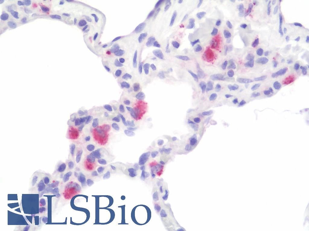 IHC-plus™ CXCL3 / GRO Gamma Antibody (aa150-200)