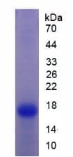 Rat TTR / Transthyretin Protein (Recombinant His)