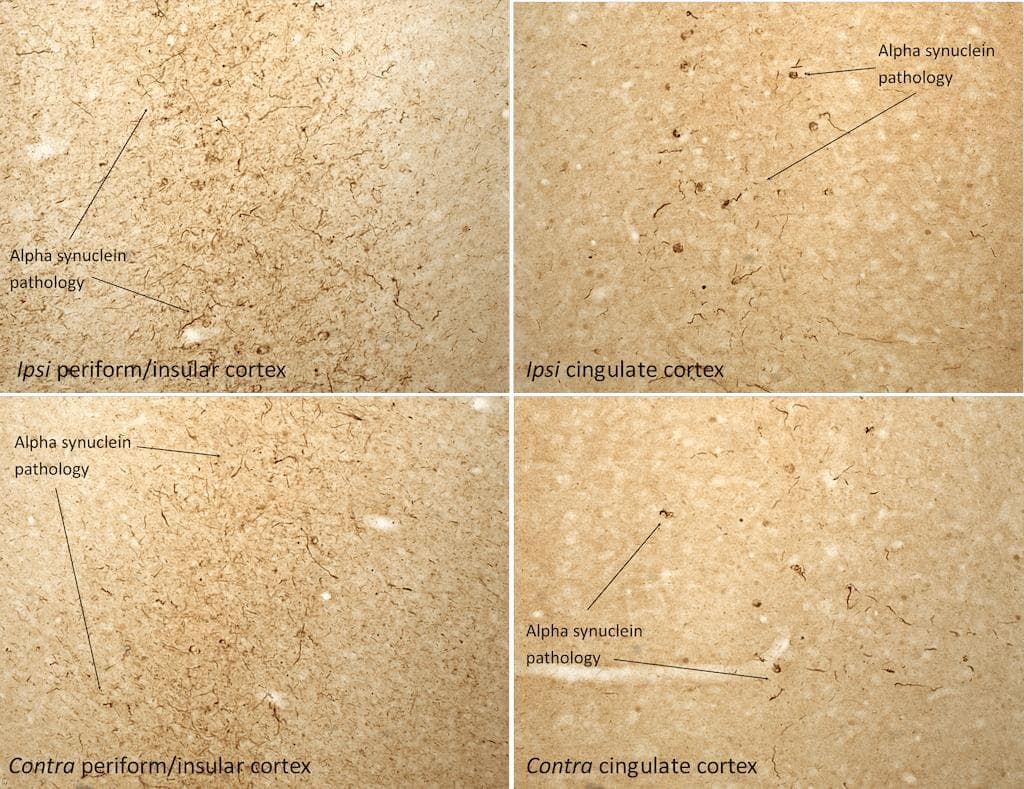 Mouse SNCA / Alpha-Synuclein Protein (Recombinant)