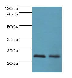 ASF1A Antibody (aa1-204)