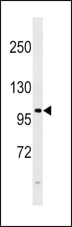 Polyclonal Rabbit anti-Human FGFR4 Antibody (aa24-55, IHC, IF, WB)
