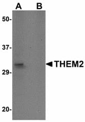 IHC-plus™ ACOT13 / THEM2 Antibody