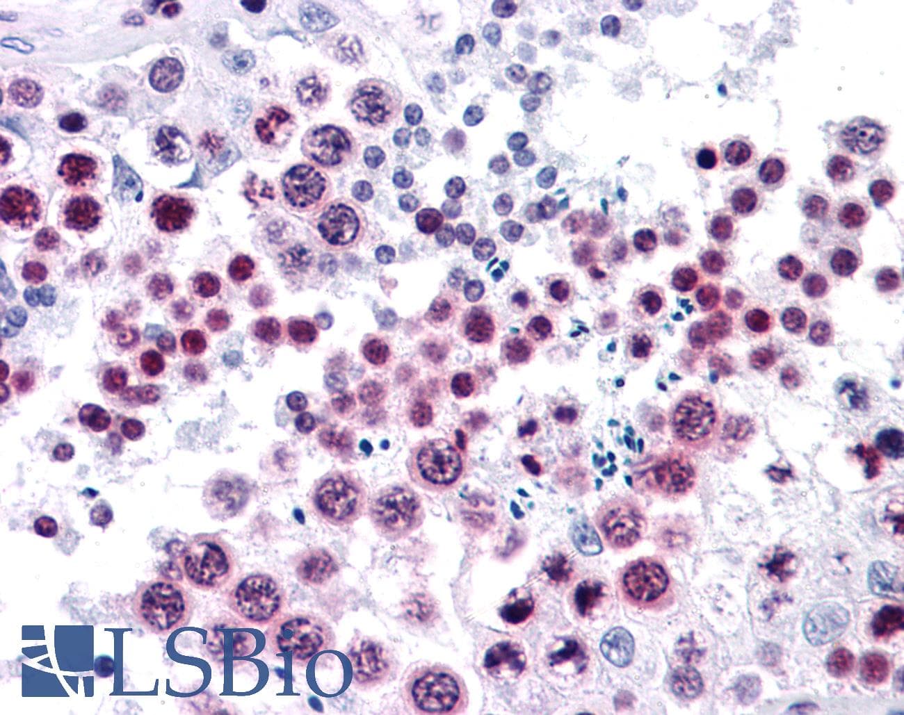 IHC-plus™ HMG1 / HMGB1 Antibody (clone 1B11)