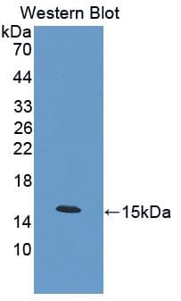 Calcitonin Antibody (aa26-136)