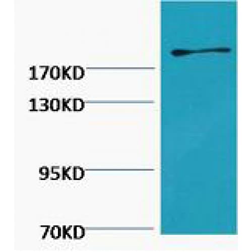 FN1 / Fibronectin Antibody (clone M9)