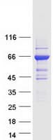 Human GBP6 Protein (Recombinant Myc-DDK (Flag))