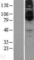 SLC22A15 / FLIPT1 Protein (Over-Expression Lysate Myc-DDK (Flag))