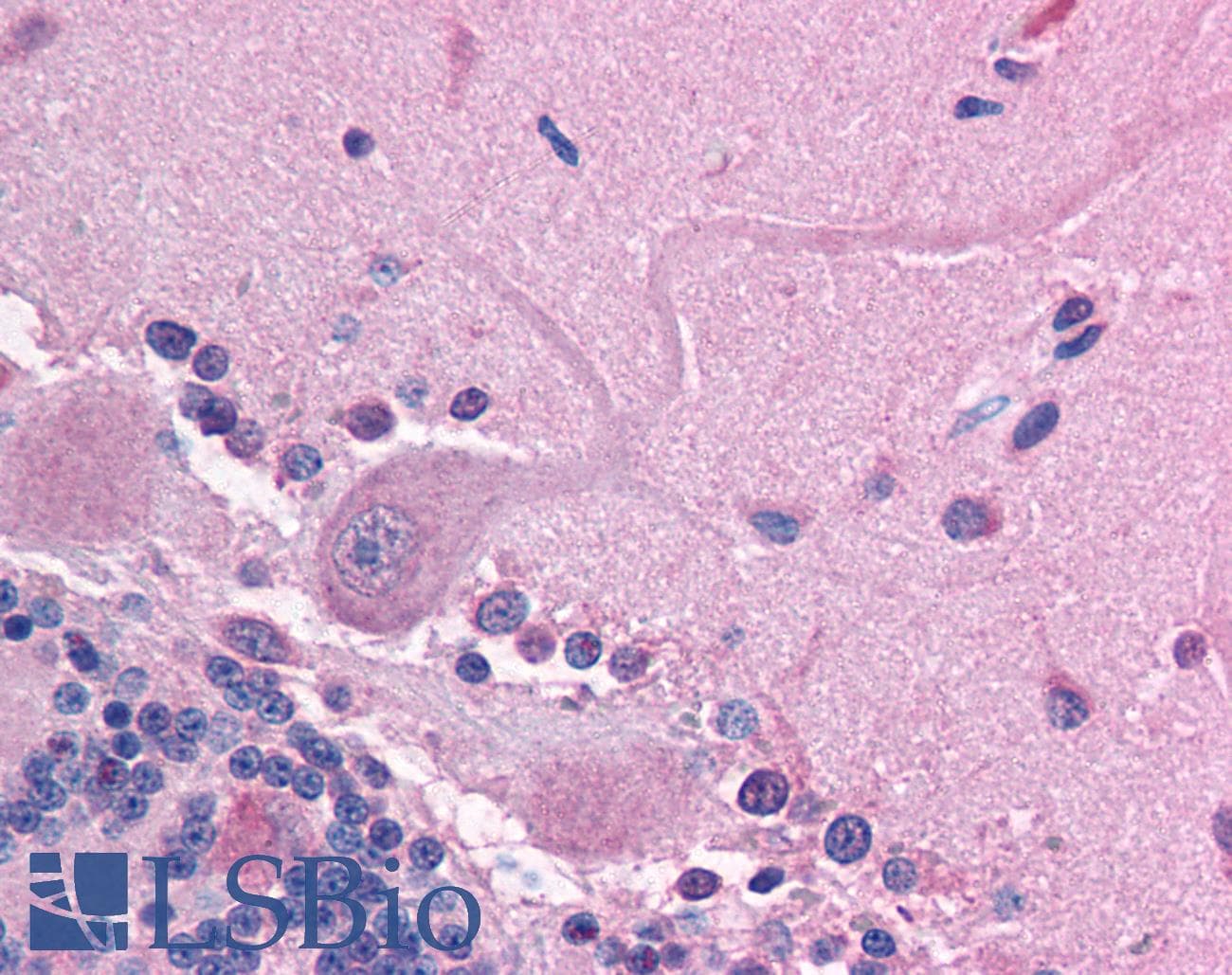 Polyclonal Rabbit anti-Human GABRE Antibody (aa237-286, IHC, WB)