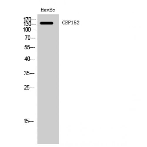 CEP152 Antibody (810-890 aa, Internal)