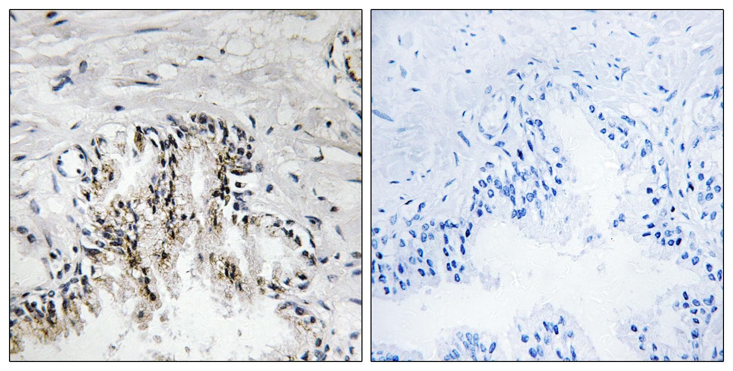 RPL31 / Ribosomal Protein L31 Antibody