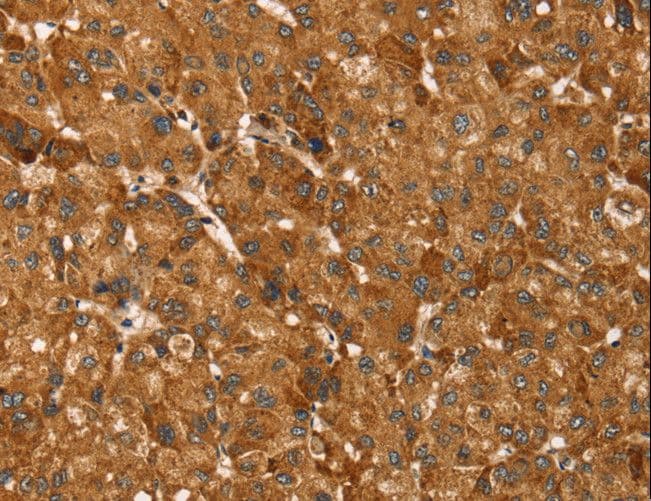 TBC1 / TBC1D1 Antibody